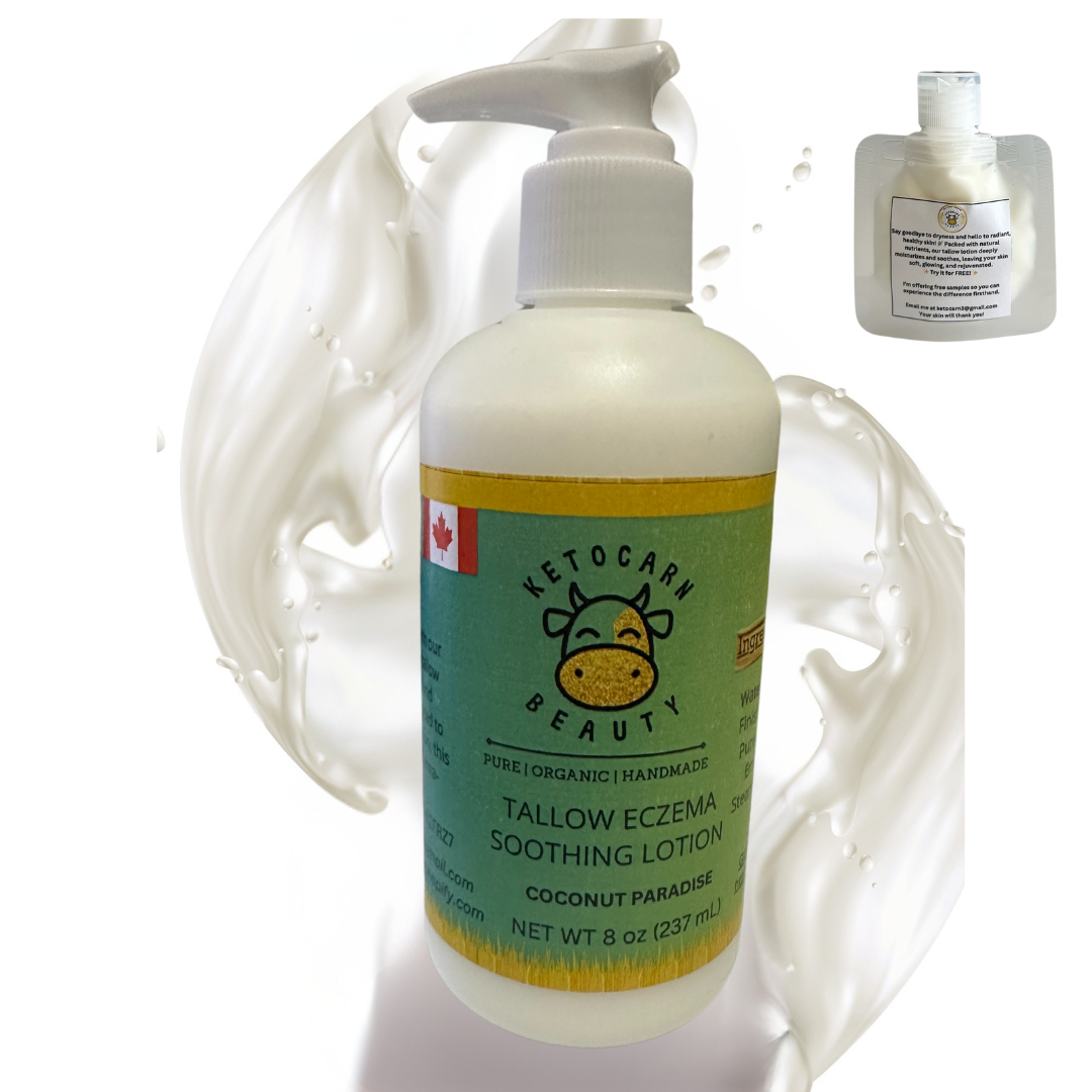 Tallow Eczema Soothing Lotion (Coconut Paradise)