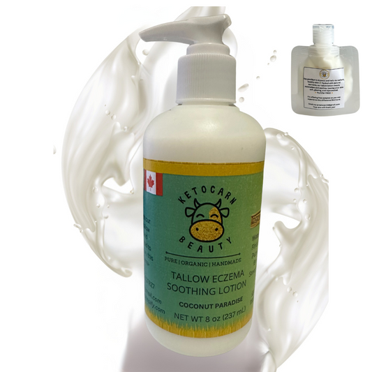 Tallow Eczema Soothing Lotion (Coconut Paradise)