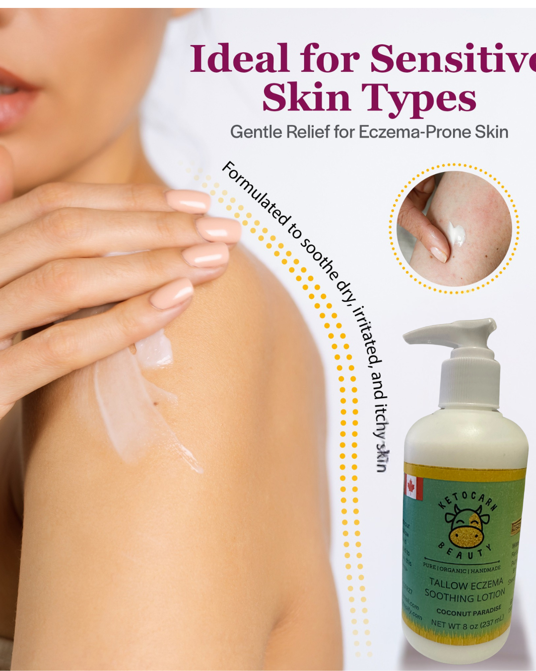 Tallow Eczema Soothing Lotion (Coconut Paradise)