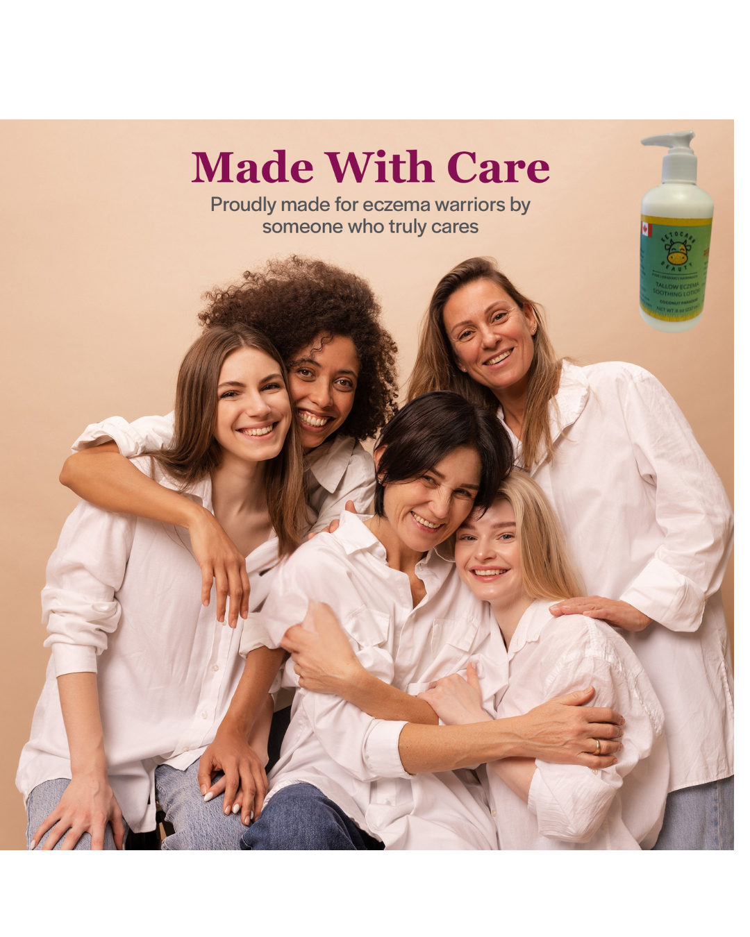 Tallow Eczema Soothing Lotion (Coconut Paradise)